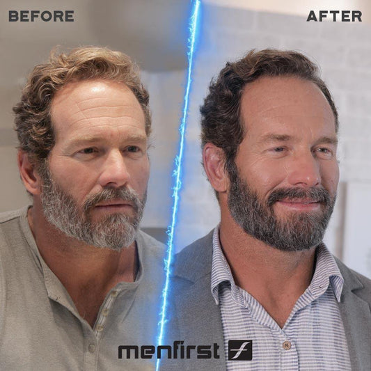 Beard Styles That Are A Rage In 2023