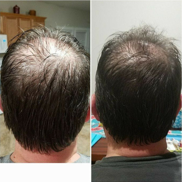 Before and After Image