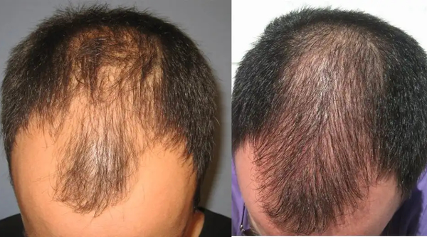 Before and After Image