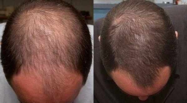 Before and After Image