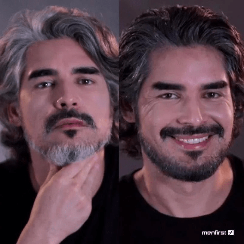 Before After