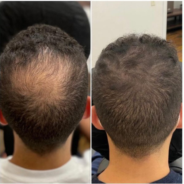 Before and After Image