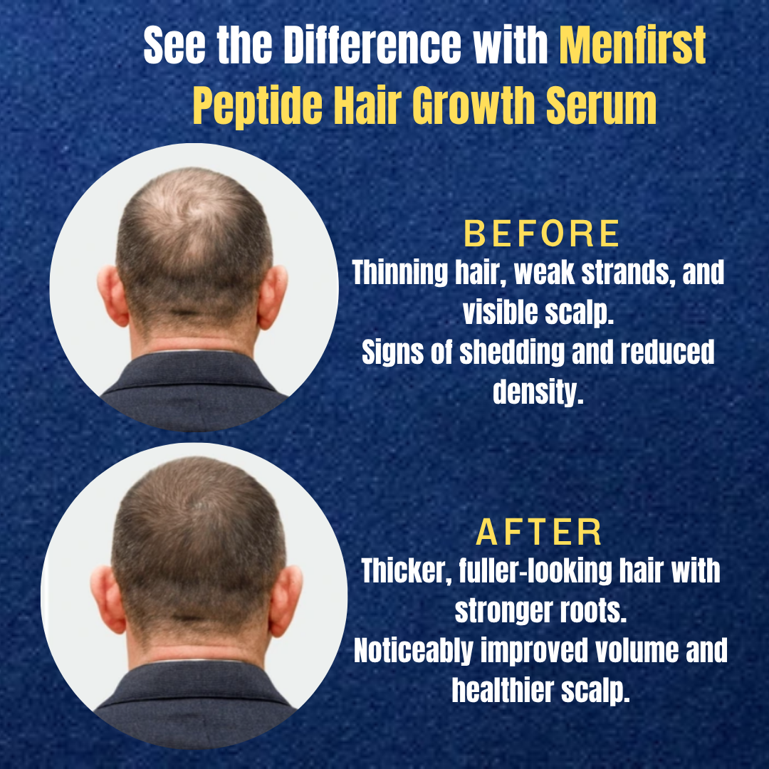 Menfirst - Peptide Hair Growth Serum to nourish and revitalize hair for a fuller, healthier look.