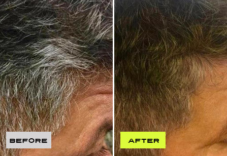 Before After