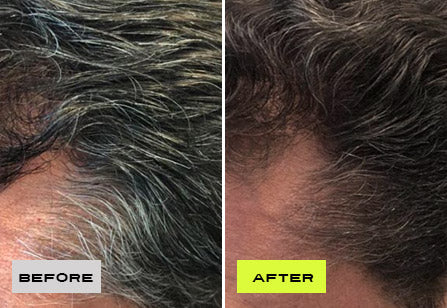 Before After